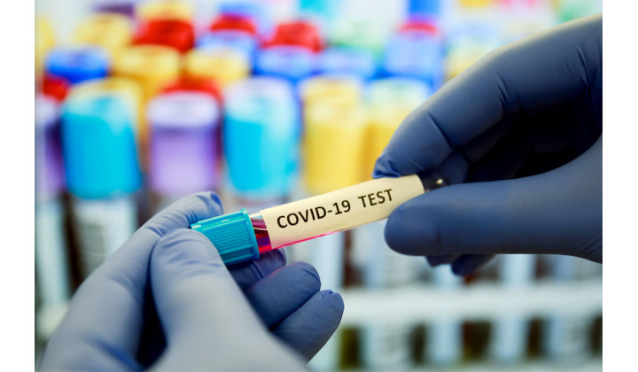 Aktuálne testovanie na COVID-19